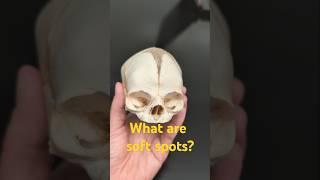 Why does a baby have soft spots? #anatomy #fetalskull