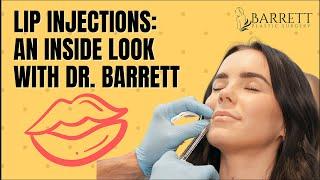 Lip Injections: An Inside Look With Dr. Barrett