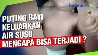 Puting Bayi Keluarkan Air Susu, Mengapa Bisa Terjadi, Ini Penjelasannya