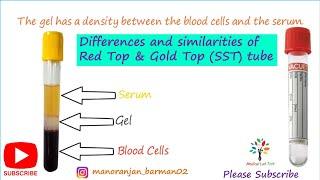 Red top vacutainer & Serum separator (Gold top) tube। Differences and similarities। #barman_sir