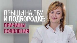 Прыщи на лбу и подбородке: что делать при появлении прыщей на лице