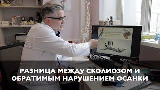 Нарушение осанки или сколиоз? | Когда нужна операция при сколиотической болезни?