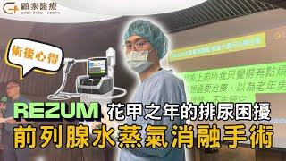 【真實案例】前列腺水蒸氣消融手術 術後心得分享(After the Rezum Procedure)－顧家醫療