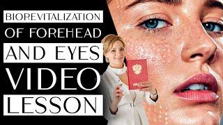 BIOREVITALIZATION of forehead and eyes video lesson