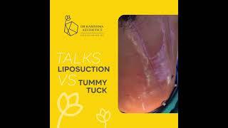 Liposuction Vs Tummy Tuck Myth Sorted  #lipo #tummytucksurgery #stomachfat #bodycontour #shorts