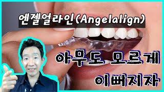 [소비폭발] 엔젤얼라인(Angelalign) : 아무도 모르게 이뻐지는 투명교정기 만드는 회사