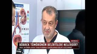 Böbrek Tümörleri - Prof. Dr. Ömer Levent Tuncay