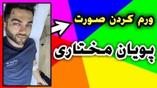 ورم کردن صورت پویان مختاری و بوس کردن نیلی افشار