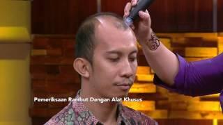 DR OZ - Topi Dapat menimbulkan Kebotakan? (29/07/2017)