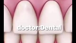 Gum disease