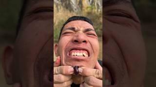 ASMR AMERICA'SHow I Cured a Bug Bite with Yogurt in the Wild | Survival Hacks