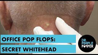 A Nice Whitehead on the Neck: OFFICE POP FLOP