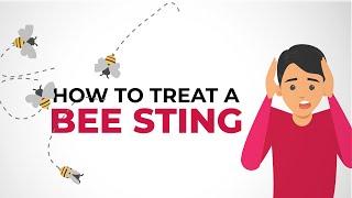 How to treat a bee sting