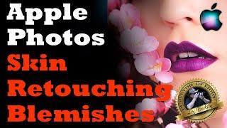 Apple Photos Skin Retouching & Blemish Removal