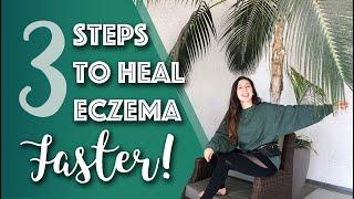 3 Steps to Get Rid of Eczema Faster - TSW, Stress, Candida // Michelle Mills