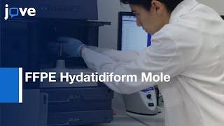 STRs Genotyping and FC Ploidy Analysis of FFPE Hydatidiform Mole | Protocol Preview