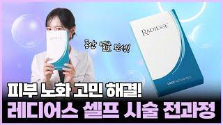 눈밑꺼짐, 팔자주름, 앞광대꺼짐 등 노화 걱정 노노! 여의사도 하는 레디어스 셀프시술 생생후기, 부천레디어스, 부천스킨부스터