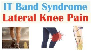 Iliotibial (IT) Band Syndrome (Common Cause of Lateral Knee Pain) |, Symptoms, Diagnosis, Treatment