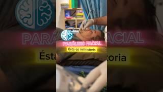 Recuperación de una Parálisis Facial #paralisisfacial #fisioterapia #fisio #cara #casodeéxito