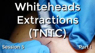 Whiteheads Extraction (TNTC) - Session 5 Part I