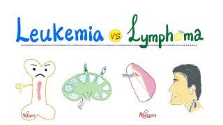 Leukemia & Lymphoma Introduction - Distinctions in Oncology - Hematology Series