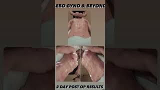 LEBO GYNO & BEYOND RESULTS