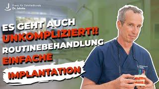 So unkompliziert & schnell geht eine einfache Implantation!