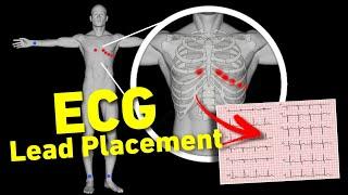 ECG lead placement MADE EASY | 12 lead ECG placement | How to perform ECG • Daily Cardiology