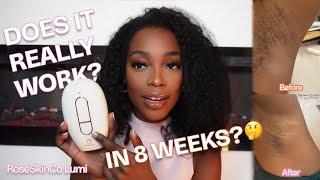 Lumi IPL by RoseSkinCo – Does It Work for Darker Skin? 8-Week Review