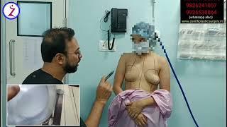 Breast Implant In Bangalore | Breast Implant Surgery Cost In Bangalore | Zenith Clinic