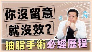 抽脂必經歷程! 抽脂諮詢, 抽脂術前與抽脂當天, 這些事你不能不知道! ｜林敬鈞醫師｜巨星整形外科