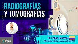 Radiografías y Tomografías | Tu Salud Guía