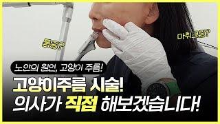 🪄주름이 없어지는 마법! "자가진피재생술" 노안의 원인, 고양이 주름 셀프 시술 영상!