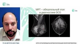 МР-биопсия неинвазивных форм рака молочной железы (Мазо М.Л.)