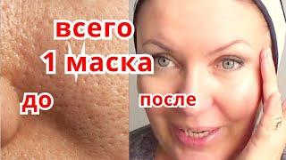 СИЛЬНЕЙШАЯ Маска для Сужения Пор !Уход за Кожей с Расширенными Порами от Морщин Рецепт