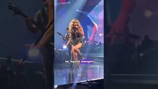carrie undwood’s leg wasn’t real anymore #celebrity #shortviedo #shorts #usa #carrieunderwood