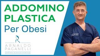 Addominoplastica per obesi - Dr Arnaldo Paganelli Chirurgo Plastico