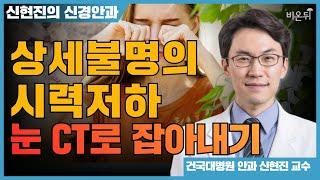 상세불명의 시력저하를 잡아내는 OCT 검사: "눈도 CT를 찍는다고?" [신현진의 신경안과#25] / 건국대병원 신현진 교수