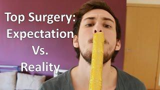 FTM Transgender: Top Surgery Expectations vs. Reality