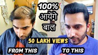 How to cure baldness/Ganjepan in male | 100% आयेंगे बाल | Hair Patch Solution | Born Creator