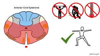 Spinal Cord Injuries