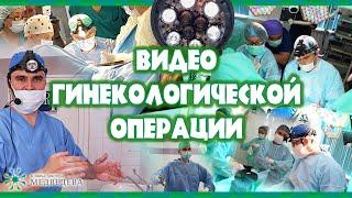 Лапароскопічна міомектомія учбовий фільм