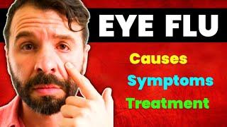 Eye Flu : Causes, Symptoms, Spread, Myths, Prevention, Treatment || Conjunctivitis || Pink Eye