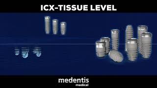 #ICX_Implant_System.