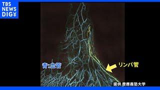 “光超音波イメージング”世界初の技術で進化！難治の「リンパ浮腫」治療の新しい取り組み｜TBS NEWS DIG