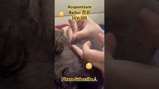 Acupuncture | Baihui (GV-20) #viral #trending #tcm #acupuncture #dr #shorts #shortsvideo