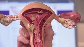 Treatment options for uterus myoma