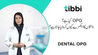 Dental X-ray (OPG) | What is OPG? | tibbi