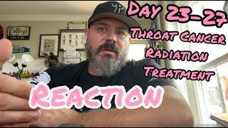 WHAT TO EXPECT | Throat Cancer | Radiation Treatment to cure my cancer | My Reactions Day 23-27