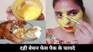 दही बेसन चेहरे पर लगाने के फायदे | Dahi besan face pack | for  boys and girls